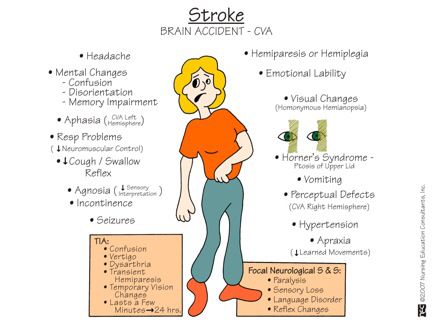 Stroke Neuro Nursing, Neurology Nursing, Emt Study, Nursing Cheat, Nursing Board, Med Surg Nursing, Medicine Notes, Nurse Study Notes, Nursing Mnemonics