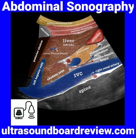 Abdominal Anatomy Abdominal Anatomy, Ultrasound Technician School, Ultrasound Student, Abdominal Ultrasound, Diagnostic Medical Sonography Student, Ultrasound School, Medical Radiography, Cardiac Sonography, Vascular Ultrasound