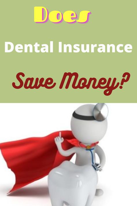 Buying dental insurance is not required by law as with other forms of coverage. Therefore, you have to decide for yourself if purchasing a plan makes sense. Dental Insurance Plans, Dental Work, Shell Game, Math Work, Tips To Save Money, Medical Insurance, Insurance Agent, Dental Insurance, Money Saver