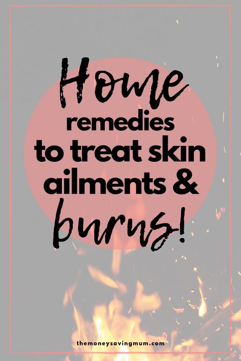 Burn Remedy, How To Heal Burns, Treat Burns, Fungal Infection Skin, Degree Burns, Natural Skin Care Ingredients, Skin Care Ingredients, Ayurvedic Healing, Skin Burns