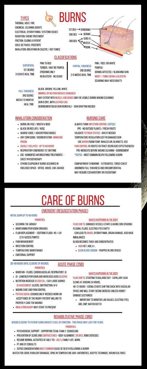 Rule Of 9 Burns, Burns Nursing, Types Of Burns, Nursing School Studying Cheat Sheets, Burn Care, Nursing Study Tips, Nurse Teaching, Nursing 101, Nursing Cheat