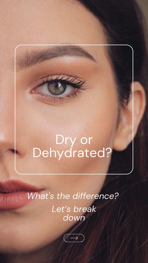 Discover the basics: Dry skin lacks oils, while dehydrated skin thirsts for water. But here's the common ground - both need your love and care. Hydrate, moisturize, and let your skin glow with health! 💧✨ Which one does your skin need more of today? #SkinCare #Skin #DryVsDehydrated #LoveYourSkin #DrySkin #DehydratedSkin Summer Skincare Products, Summer Skincare, Life Tips, Beauty And Lifestyle, My Skin, Skincare Products, Self Care, Self Love, A Woman