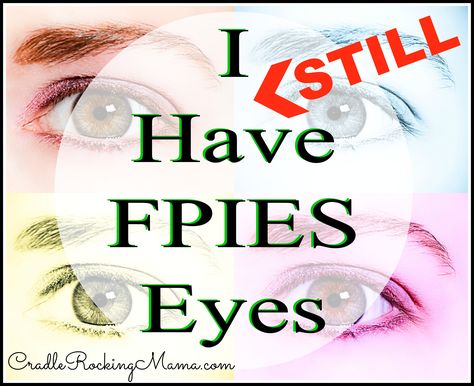 I Still Have FPIES Eyes CradleRockingMama.com Food Allergy Awareness, It’s A Wonderful Life, Food Allergies Awareness, Allergy Awareness, A Wonderful Life, Food Allergy, Wonderful Life, Food Allergies, Real Food Recipes