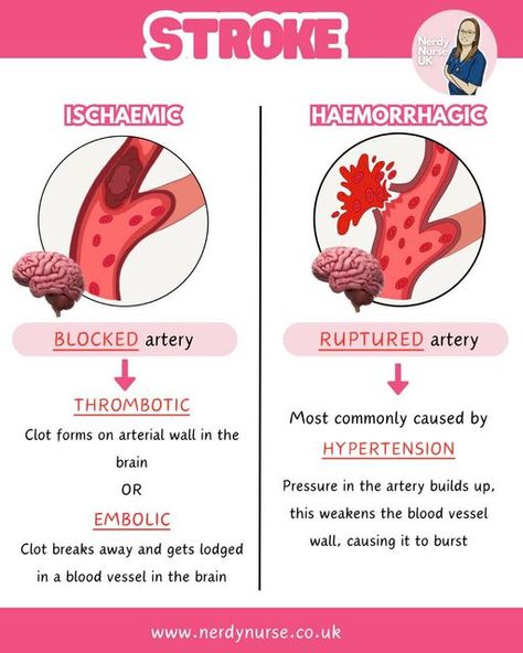 Lauren - Nursing made easy on Instagram: "Ischaemic vs haemorrhagic stroke  A very simple overview  #nursingclinicals #pathophysiologyclass #pathophysiologynotes #nursingstudentsofinstagram #studentnursestudytips #nursingstudentnotes #studentnurses #futurenurses #nursingresources #nurseintraining #nurseinprogress #adultnursing #nursetobe #nursingassociates #traineenursingassociates #traineenursingassociate #studentparamedicuk #studentparamedicsuk #studynursing #studentnurseuk #studentnurse #nursingnotes #nursingschool #nursingstudent #studentnursesofinstagram #studentparamedic #pathophysiology" Gi Nursing, Med Surge, Pathophysiology Nursing, What Is Intelligence, Ulnar Nerve, Nursing School Essential, Student Tips, Nursing School Motivation, Heath Care