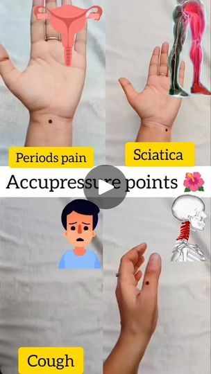 Periods Pain, Acupressure Point, Cervical Pain, Period Pain, Acupressure Points, Sciatica, Acupressure, Pain Relief, Healthy Living