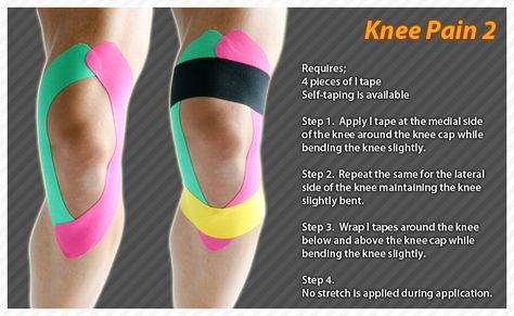 Taping Knee For Pain, Knee Taping For Pain, Kinesiology Taping Knee, Kinesio Taping Knee, Knee Taping, K Tape, Kinesio Tape, Kt Tape, Knee Pain Exercises