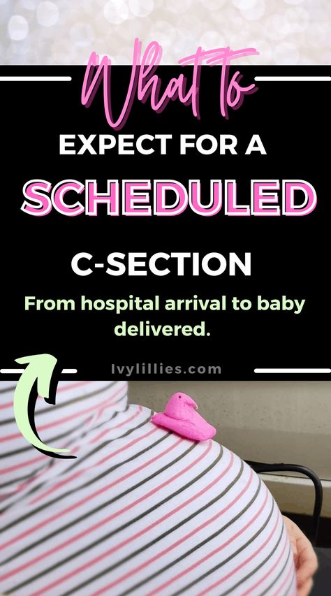 C Section Recovery Timeline, Labor Symptoms, Scheduled C Section, C Section Recovery, Just My Luck, Induce Labor, Hospital Bag Checklist, Pregnancy Labor, Hard Breathing