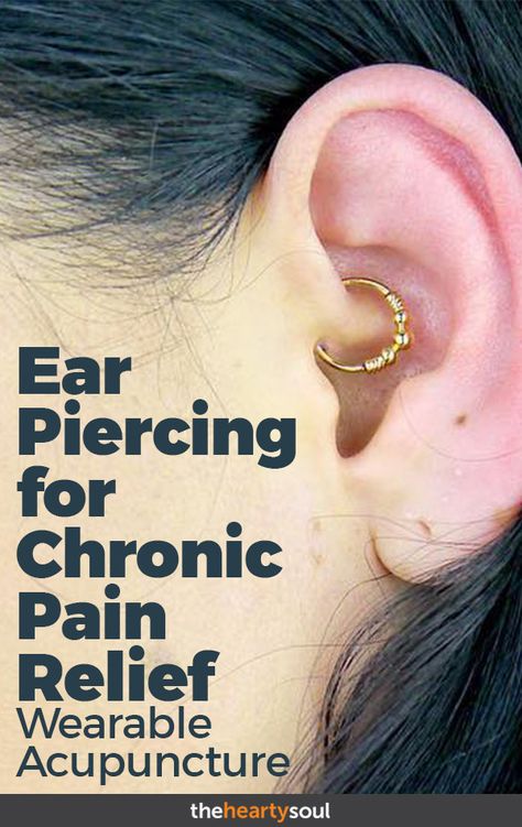 Is Daith Piercing The Chronic Pain Cure You've Been Looking For? | The Hearty Soul Acupuncture Migraine, Autoimmune Lifestyle, Migraine Piercing, Piercing Daith, Chronic Pain Relief, Chronic Migraines, Health Ideas, Migraine Relief, Shiatsu Massage