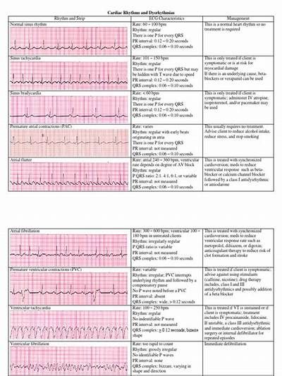 dysrhythmia interpretation | Cardiac nursing, Critical care nursing, Nurse Cardiac Dysrhythmias Cheat Sheets, Cardiac Nursing Cheat Sheets, Cardio Nursing, Cardiac Dysrhythmias, Doctor Stuff, Cardiac Sonography, Ekg Interpretation, Ecg Interpretation, Paramedic School