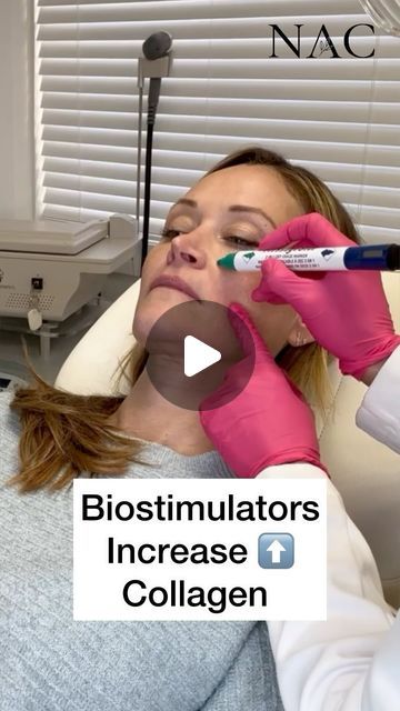 48K views · 1K likes | Dr. Bita Zadeh Farrell on Instagram: "Biostimulatory injectables stimulate collagen (as the name suggests). They provide gradual and long lasting results. Collagen induction restores and renews natural firmness of the skin to treat loose skin and wrinkles.  Ideal age to start is mid 30s, on average, 2-3 treatments are required and results last up to 2 years.   #biostimulator #collageninduction #radiesse #calciumhydroxylapetite #drbitafarrell #naturalaestheticscenter" Collagen Injections, Mid 30s, Medical Aesthetics, Medical Aesthetic, Loose Skin, Med Spa, The Skin, Wrinkles, To Start