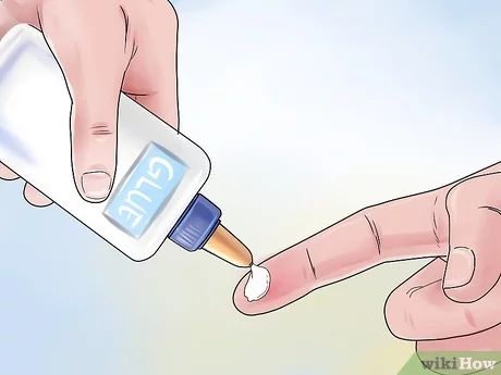 How to Remove a Splinter: 3 Removal Methods Remove A Splinter, Emergency Medical Responder, Splinter Removal, Anthony Stark, Medical Help, Rubbing Alcohol, Cotton Ball, Emergency Medical, Household Tips