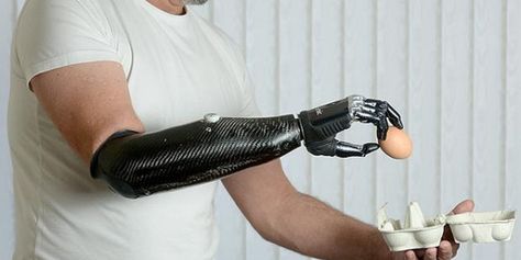 Nigel Ackland, has bionic carbon fibre mechanical hand – the world’s most advanced prosthetic limb   Nigel Ackland, 53, has been fitted with a carbon fibre mechanical hand, which he can control with the muscles in his upper arm.   Source: http://techandfacts.com/bionic-crbon-fibre-mechanical-hand Robotic Prosthetics, Prosthetic Leg, Humanoid Robot, Cool Tech Gadgets Electronics, Biomedical Engineering, Mechanical Hand, Terminator, Tie Shoes, Auckland