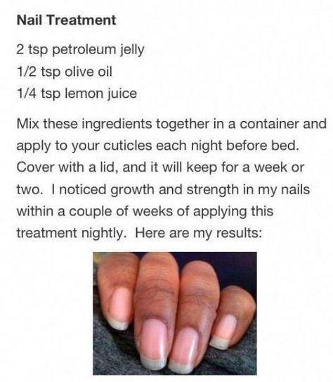 Consejos naturales #Crecimientodelasuñas Nail Growth Tips, Natural Gel Nails, Types Of Manicures, Nail Care Tips, Nail Care Routine, How To Grow Nails, Brittle Nails, Nail Growth, Nail Fungus