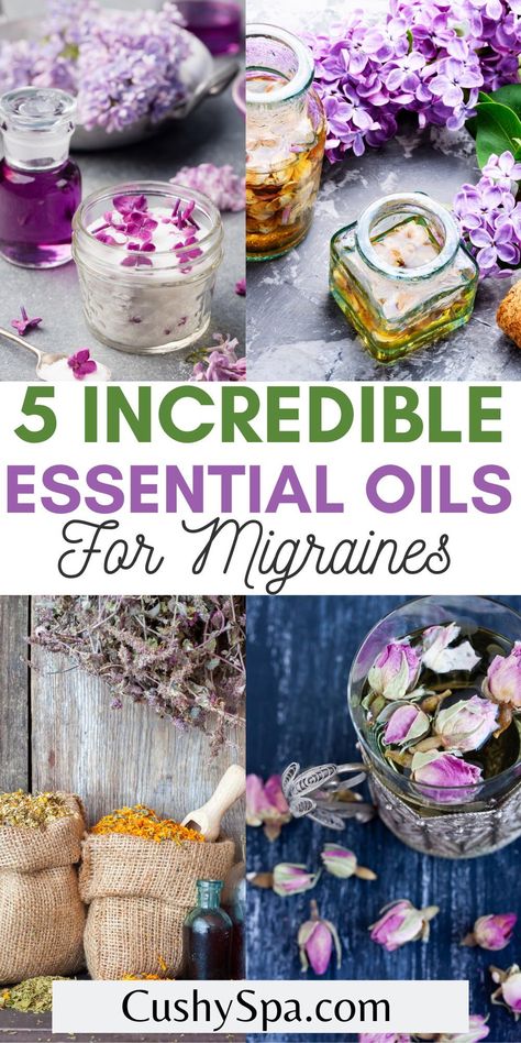 Essential Oil For Headaches, Migraine Relief Essential Oils, Oils For Migraines, Remedy For Sinus Congestion, Essential Oils For Migraines, Home Remedies For Sinus, Natural Migraine Relief, Natural Headache, Natural Remedies For Migraines