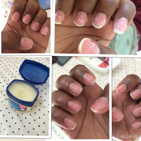 After taking acrylic nails off file nails as smooth as possible and rub Vaseline onto nail and cuticles... This helps get rid of the white lines in nails Nail Care After Acrylics, How To File Nails, How To Remove Acrylic Nails, Take Off Acrylic Nails, Nails After Acrylics, File Nails, Manicure Station, Split Nails, Remove Acrylics