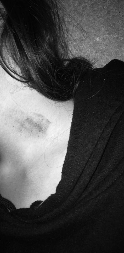 Hickey on neck, love bite, hickie Hickies Neck Boys And Girl, Hickies Neck Aesthetic Girl, Hicks On Neck, Hickies Neck Aesthetic, Hickies Neck, Neck Aesthetic, Corp Perfect, Creepy Images, Art Sketches Doodles