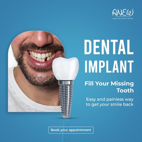 This image is about Dental implants at Anew Cosmetic Clinic in Bangalore Dental Implant Poster, Implant Dental, Dental Ads, Never Stop Smiling, Dental Poster, Implants Dental, Clear Aligner, Dental Advertising, Dental Social Media