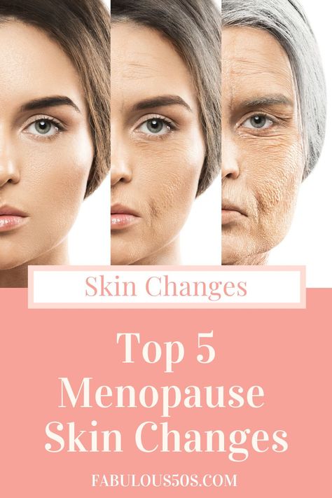 Women Over 50 Oftentimes Experience Menopause-related Skin Changes. Many Of These Conditions Exist Due To The Decrease In Estrogen Women Experience In Menopause.#womenover50lifestyle #over50lifestyletips #50yearoldwomenlifestyle #richwomenlifestyle #lifestyleblogsforoldwomen Facial For Dry Skin, Fabulous 50, Interweave Crochet, Female Health, Low Estrogen, Dry Skin On Face, Dry Skin Remedies, Hormone Balance, Brightening Skin