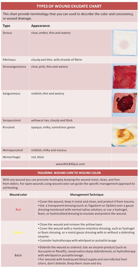 Wound Assessment, Nursing Apps, Nursing Documentation, Chart Cheat Sheets, Nerdy Nurse, Wound Care Nursing, Wound Care Dressings, Type Chart, Home Health Nurse