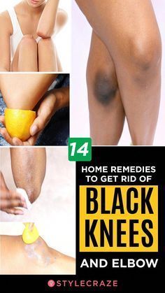 How To Lighten Knees, Dark Elbows, Skin Care Routine For 20s, Dark Underarms, Beauty Tips For Glowing Skin, Beauty Tips For Face, Penteado Cabelo Curto, Black Knees, Beauty Skin Care Routine