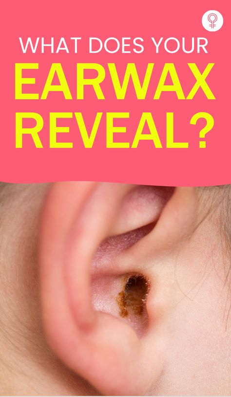 What Does Your Earwax Reveal? The color of the earwax varies from person to person and essentially speaks about the person’s genetic origin. It also shows the amount of secretions produced by the apocrine glands (the glands that secrete an oil-like substance to form earwax) and suggests the presence of a possible medical condition. #earwax #health #healthcare #healthtips Clean Ear Wax Out, Impacted Ear Wax, Ear Wax Removal Video, Outer Ear, Cleaning Your Ears, Health Podcast, Ear Wax Removal, Menstrual Health, The Dating Divas