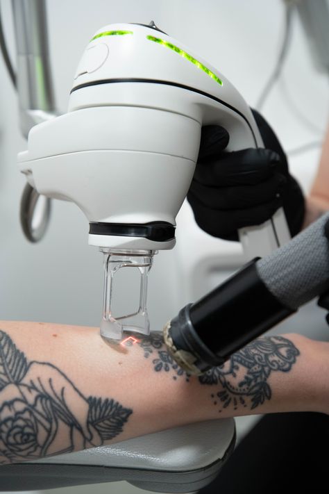 Tattoo removal laser about to begin on an arm tattoo. Tatto Designs, Remove Tattoo, Pico Laser, Famous Tattoos, Laser Clinics, Intricate Tattoo, Creative Hub, Laser Tattoo, Laser Tattoo Removal