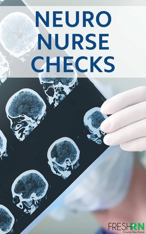 Must-Know Tips For Neuro Nurse Checks. These are the most essential tips you need to know when you do your neuro nurse checks, all told from a nurse who has been there. #FreshRN #nurse #nurses #neuro #neuronurse #neurochecks Neurology Nursing, Pacu Nursing, Neuro Nurse, Nurse Career, Nerdy Nurse, Nursing Classes, Health Assessment, Nursing Courses, Nursing Pins