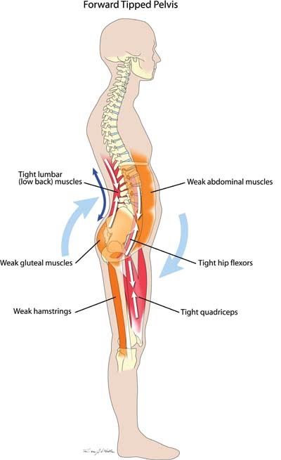 Release your back pain in 5 minutes Psoas Release, Back Muscle, Gluteal Muscles, Lower Back Muscles, Pelvic Tilt, Yoga Anatomy, Tight Hip Flexors, Muscle Imbalance, Hip Flexors