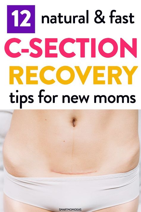 Postpartum tips to help with your csection recovery plan. Learn 12 natural and fast c-section recovery tips to help speed the healing during your first week home as a new mom. #postpartum #givingbirth #csection Postpartum Must Haves, Postpartum Care Kit, Body After Baby, C Section Recovery, Cesarean Section, Postpartum Belly, Postpartum Body, Baby Sleep Problems, Postpartum Care