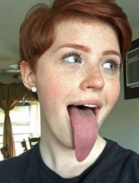 Beautiful Freckles, Tongue Health, Funny Face, Red Heads, Herbal Remedies, Redheads, Red Hair, Home Remedies, Natural Remedies