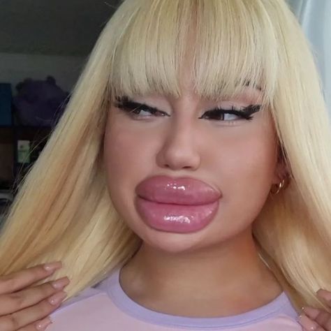 789 Likes, 28 Comments - MoxieFair (@moxiefair) on Instagram: "🧸" Funny Filters, Face Fillers, Botox Lips, Fake Lips, Drag Queen Makeup, Nicki Minaj Pictures, Female Faces, Love Lips, Really Long Hair