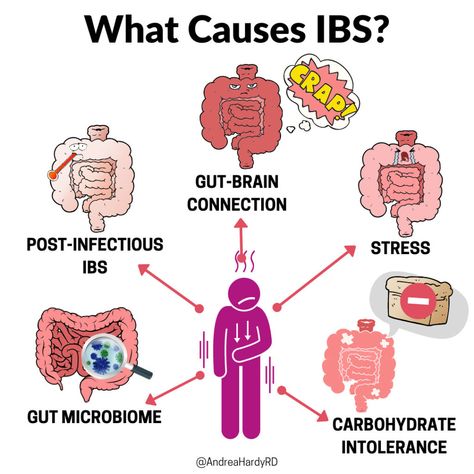 Irritable Bowel Syndrome Types, Causes, and Symptoms - Andrea Hardy, RD Osmotic Pressure, Brain Connections, Gut Brain, Gut Microbiota, Irritable Bowel, Gut Microbiome, Patient Experience, Brain Activities, Abdominal Pain