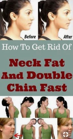 You can hide your belly fat, love handles and chubby arms in photos, but one thing that’s always out in the open and impossible to cover up is your double chin. . . #dietplan #diettips #exercise #workouttips #workout Chin Workout, Neck Fat Exercises, Belly Massage, Reduce Face Fat, Chest Workout Women, Gallbladder Diet, Gut Diet, Double Chin Exercises, Chin Exercises