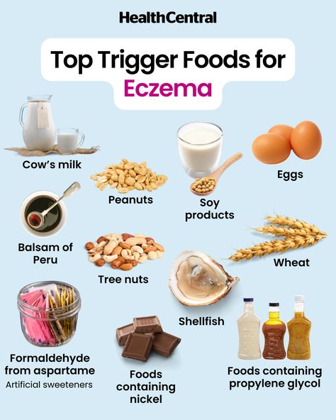 Shellfish Allergy, Common Food Allergies, Health Chart, Unhealthy Diet, Nickel Allergy, Soy Products, Nutrient Rich Foods, Gut Healing, Processed Meat