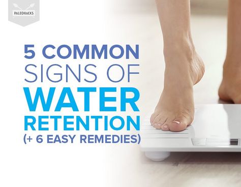 5 Common Signs of Water Retention (+ 6 Easy Remedies) | PaleoHacks Swollen Legs Remedies, Water Retention Causes, Reduce Water Retention, Water Retention Remedies, Routine School, Retaining Water, Swollen Legs, Fluid Retention, Health And Fitness Articles