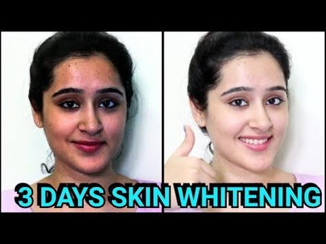 Skin Cleanser Diy, Skin Whitener, Spotless Skin, Mask For Oily Skin, Skin Care Routine For 20s, Skin Lightening Cream, Word Quotes, Skin Pigmentation, Hey Beautiful