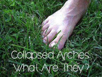 Collapsed Arches: What Are They? - 30 Something Mother Runner Plantars Wart Remedy, Planters Warts On Foot, Planter Warts Remedies, Planters Wart, Apple Cider Vinager, Plantar Warts, Warts Remedy, 30 Something, Fallen Arches