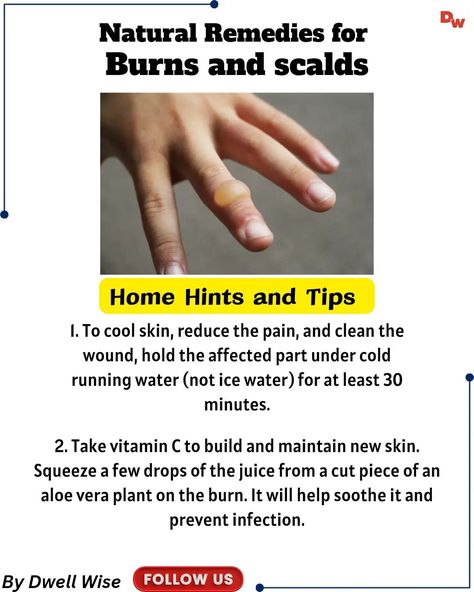 Natural remedies for burns and scalds #naturalhealing #naturalremedies #burns #scalds #homepractice Natural Remedies For Burns, Remedies For Burns, Skincare For Dark Spots, Burn Remedy, Facial Massage Techniques, Holistic Home, Remedies For Skin, Aloe Vera Plant, Clear Skin Tips