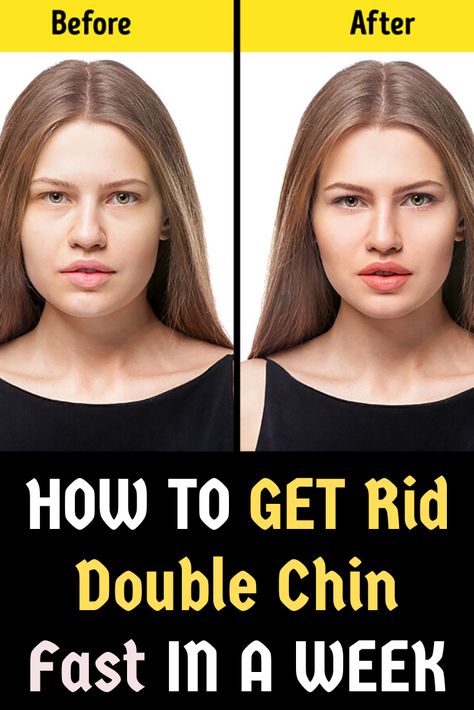 Massage Double Chin, Double Chin Massage, Chin Massage, Remove Double Chin, Rid Of Double Chin, Cheek Fat, Reduce Face Fat, Jawline Exercise, Double Chin Removal