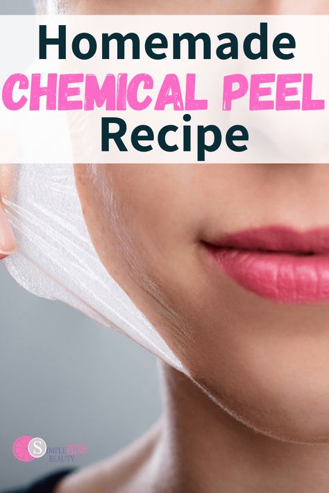 Mary Kay Facial Peel, Homemade Face Peel, Diy Facial Peel, Diy Chemical Peel, Nose Peeling, Diy Peel Off Mask, Chemical Face Peel, Best Chemical Peel, Face Peel Mask