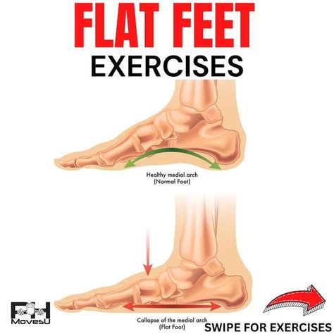 Peter Hanc on Instagram: "💥Flat Feet💥 - ⁉️ Have a flat feet?! - 💥 Having flat feet doesn't mean much as shape of your arch is largely determined by genetics, so thinking about building up your foot strength is the way to go - as it will improve stress tolerance, control, and balance, which transfers into better foot function and less aches and pains if you experience any. - 🎥 Exercises shown here: - 1️⃣ Short Foot with Towel Feedback 2️⃣ Big Toe/Little Toes Taps 3️⃣ Arch Contract/Relax 4️⃣ D Flat Foot Exercises, Ankle Rehab Exercises, Flat Feet Exercises, Yoga Asanas Names, Flat Feet Pain, Plantar Fascitis, Physical Therapy School, Heel Spur, Feet Therapy