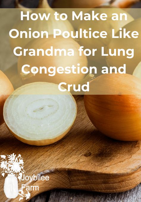 An onion poultice is a simple and historical folk remedy to relieve lung congestion, pneumonia, and coughs. It works against bacteria and helps your body break up mucus and congestion. This poultice can be made at home in just a few minutes, and is gentle enough for adults and children. Natural Remedies For Pneumonia, Onion Poultice, Pneumonia Remedies, Congestion Remedies, Sick Remedies, Home Remedy For Cough, Nature Style, The Onion, Cold Home Remedies