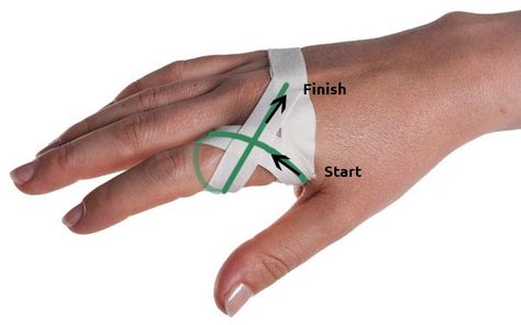 This is a GREAT site! Sprained Knuckle Taping Step 2 | Physical Sports First Aid; 1/16/2016 - this helped my pain more than just about anything else i tried (RSI - index joint at the hand); *I used sensitive skin paper tape under the adhesive tape to reduce skin damage from removal; See also Thumb Spica Taping. How To Tape Fingers For Volleyball, Athletic Training Sports Medicine, Kinesio Tape, First Aid Tips, Kinesio Taping, Sports Therapy, Sports Tape, Kinesiology Taping, Basketball Workouts