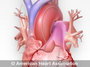 Cardiac Catheterization | American Heart Association Cardiac Cath, Heart Catheterization, Heart Arteries, Heart Valve, Acute Coronary Syndrome, Nursing Cheat, Chest Discomfort, Interventional Radiology, Heart Valves