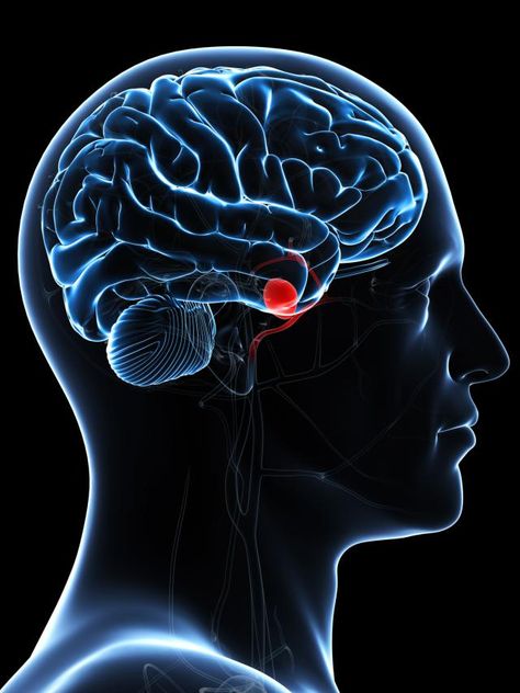 What to expect from a brain aneurysm. Learn more about what an aneurysm is and the prognosis of a brain aneurysm. Brain Aneurism, Throbbing Headache, Foot Reflexology Massage, Brain Surgeon, Congenital Heart, Reflexology Massage, Coronary Arteries, Brain Surgery, Migraine Headaches