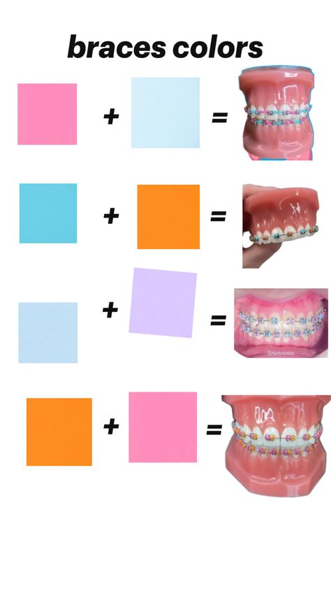 inspirational Best Braces Colors, Brace Ideas, Braces Hacks, Dental Braces Colors, Braces Colors Combinations, Braces Colours, Pink Braces, Braces Colors Ideas, Braces Ideas