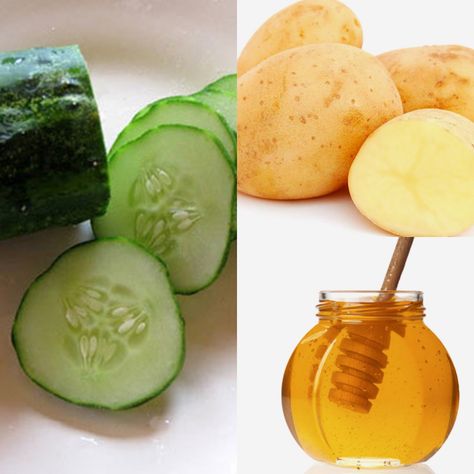 THE BEST HOME REMEDIES FOR BAD SUN RAYS IN SOUTH AFRICA Home Remedies For Sunburn, Cold Water Bath, South African Women, Vinegar Cucumbers, Sunburn Remedies, Honey Tea, Peeling Potatoes, Sun Rays, African Women