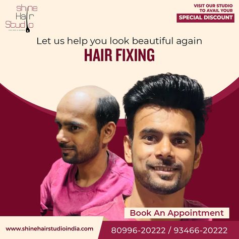 Our stylists understand the importance of a boost in confidence and are dedicated to helping you look and feel your best. By using hair patches, we can help you look refreshed, feel more confident, and regain your true appearance. Feel free to contact our customer service hotline at |+91 9346620222 | +91 8099620222 | +919705720222 | +91970582222| #hairservices #Hyderabad #Madhapur #Vijayawada #Vizag #Rajamahendravaram #Rajahmundry #chatgtp Hair Patches For Men, Hair Replacement Systems, Nothing To Lose, Hair Fixing, Feel More Confident, Graphic Design Photoshop, Design Photoshop, Hair Replacement, Restoration Services