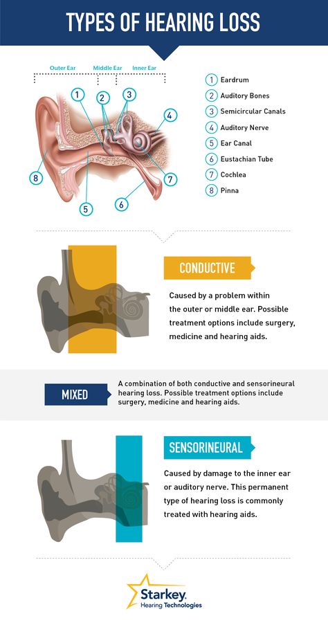 Types of hearing loss Deaf Awareness, Speech And Hearing, Deaf Education, Middle Ear, Deaf Culture, Hearing Health, Ear Health, Speech Pathology, Speech Language Therapy