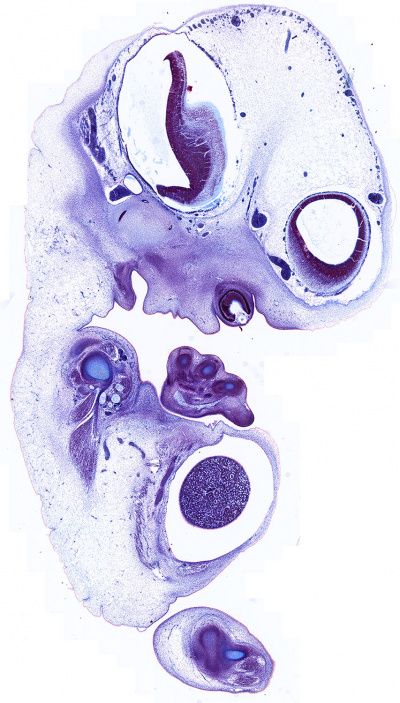 Carnegie stage 18 - Embryology Embryology Aesthetic, Embryology Art, Rehabilitation Aesthetic, Embryo Drawing, Transformation Reference, Embryo Art, Science Artwork, No Emotions, Nursery Drawings